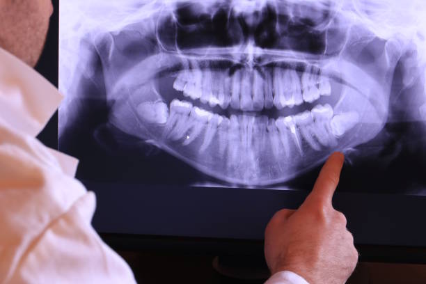 Best Urgent Care for Lost Fillings or Crowns in Pinehurst, MA