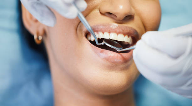 Best Emergency Treatment for Dental Infections or Abscesses in Pinehurst, MA